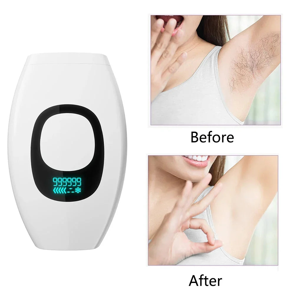 SilkSkin Pro – The Ultimate Laser Hair Removal Device