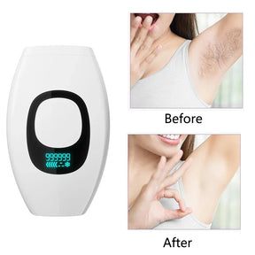 SilkSkin Pro – The Ultimate Laser Hair Removal Device